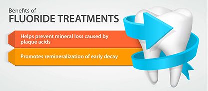 Fluoride Treatments